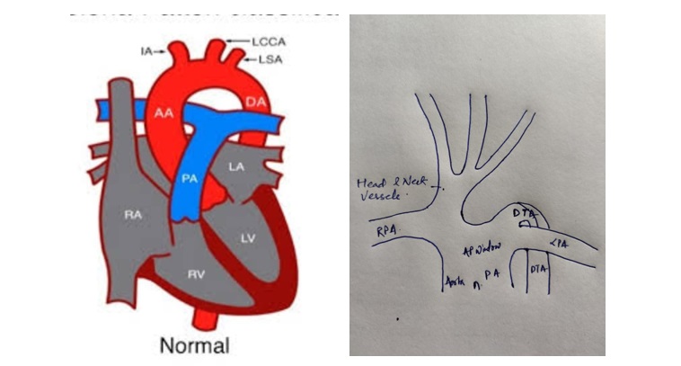 Dr. Sourabh Sharma Cardiac surgeon in Kota