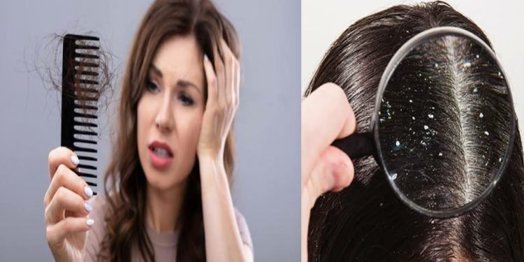 Hair Fall Solution in Hindi