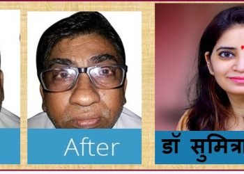 पैन किलर्स हमारी आँखों की पलकों