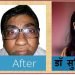 पैन किलर्स हमारी आँखों की पलकों