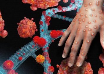 A serious disease that hit the world