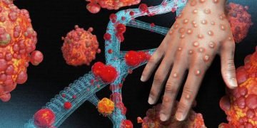 A serious disease that hit the world