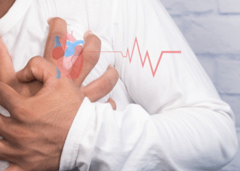 Never Ignore Repeated Episodes of Rapid Heartbeat