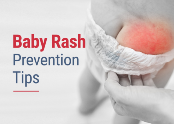 Baby Rashes in Indian Climate: Everyday Prevention Tips for Parents