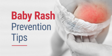 Baby Rashes in Indian Climate: Everyday Prevention Tips for Parents