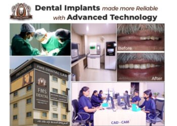 Dental Implants How Advanced Technology Is Making Tooth Replacement More Reliable