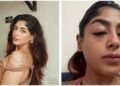 Splitsvilla Contestant Suffers Broken Tooth and Swollen Eyes Preet Singh Alleges Assault at a Club