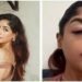 Splitsvilla Contestant Suffers Broken Tooth and Swollen Eyes Preet Singh Alleges Assault at a Club