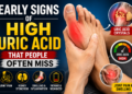 High Uric Acid Symptoms: Warning Signs You Should Never Miss